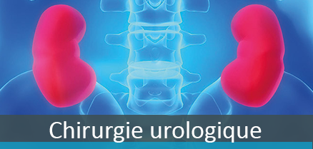 Chirurgie urologique